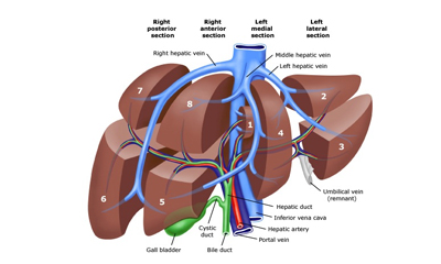 Liver Resection For Hepatocellular Cancer HCC