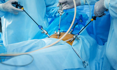 Laparoscopic Liver Surgery