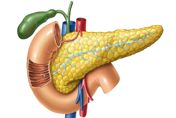 Acute Pancreatitis